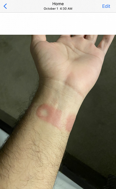 Appla Watch 