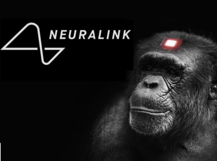 Neuralink